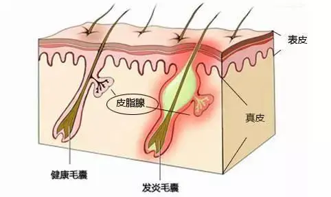 为什么全身上下，脸部的皮肤最差？